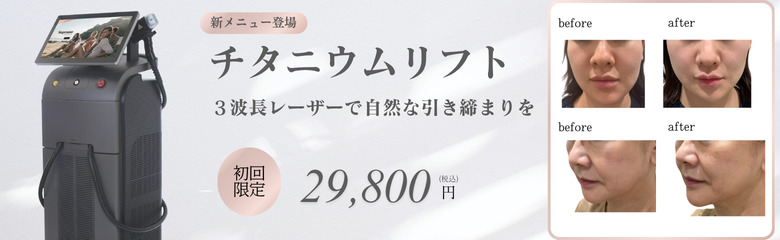 チタニウムリフト